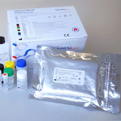 Lionex - TB Sitotoksik Antijen Testi